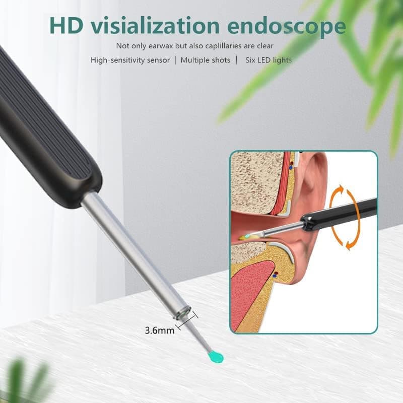 Smart Ear Cleaner with 1296P HD Camera, Wireless Earwax Removal with WiFi Endoscope, Safe Inspection and Intelligent Temperature Control, White
