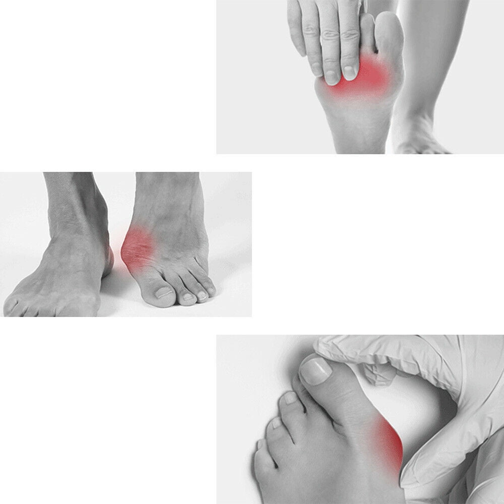 Onemayship Silicone Gel Toe Separator Orthotics Bunion Toes Spacer Pain Reliever 12Pcs