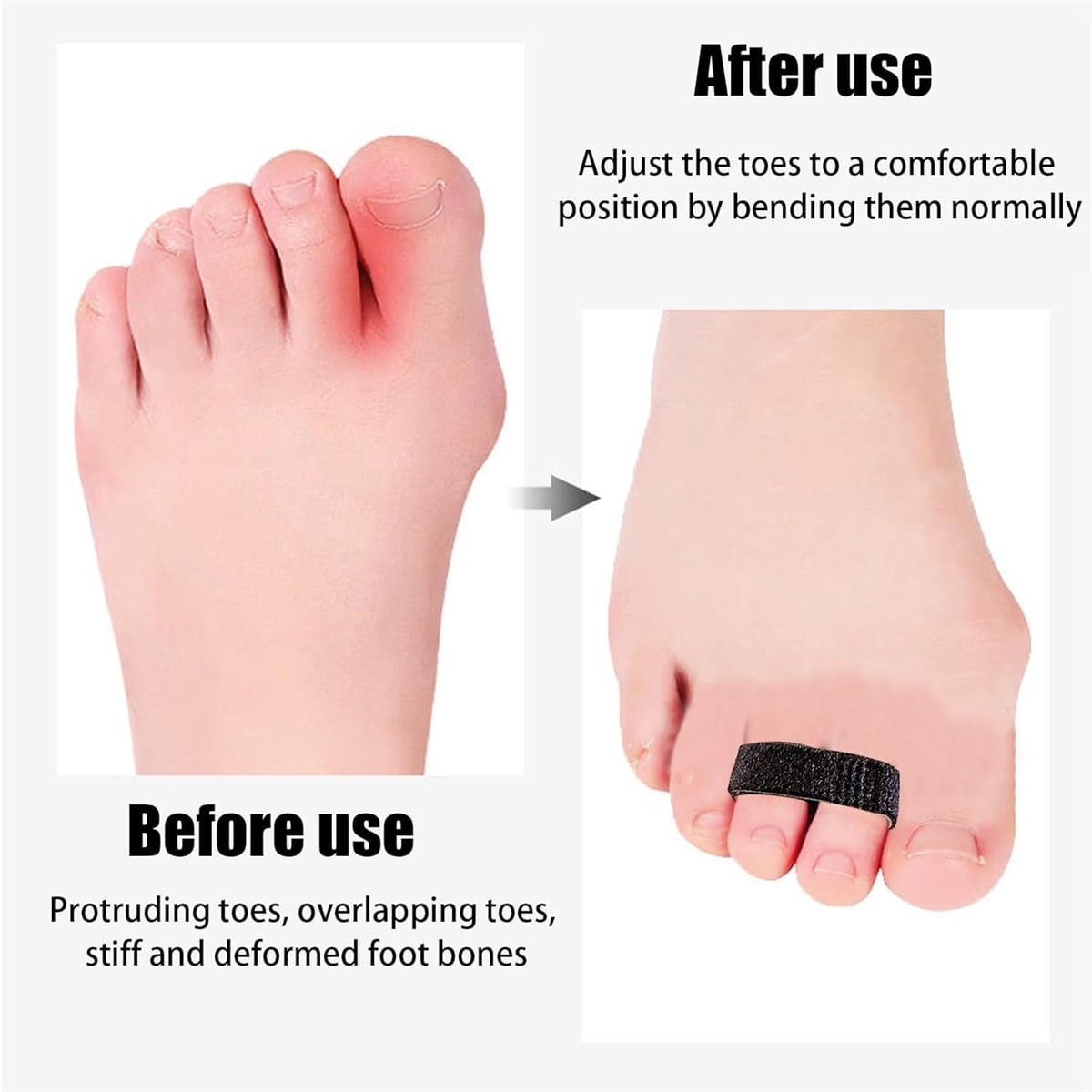 Hook and Loop Finger Wrap,Tutuviw 10 Pcs Washable and Reusable Buddy Straps for Fingers,Buddy Tape Finger Straps,Toe Separator for Bunion,Finger Brace for Injured/Jammed/Trigger Finger Support(Black) Black