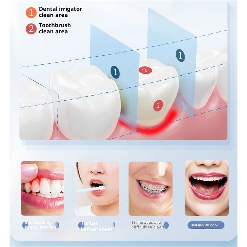 Mini Water Flosser for Travel, Ultra-Portable Cordless Oral Irrigator, IPX7 Waterproof 4 Modes, 180mL Teeth Cleaner for Tonsil Stones & Braces Care - Home & Travel