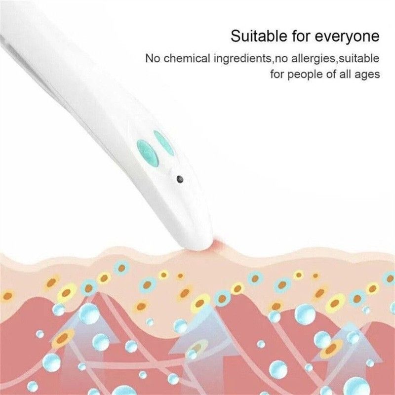 The  Electronic Bug bite Treatment for Mosquito Bites,Without Chemicals - Treatment by Heat, Each battery pack can be used up to 300 times  including batteries