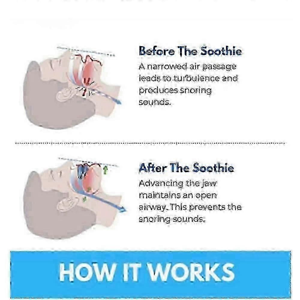 Honex Anti-Snoring Mouthpiece - Quite Night Device, PC+EVA