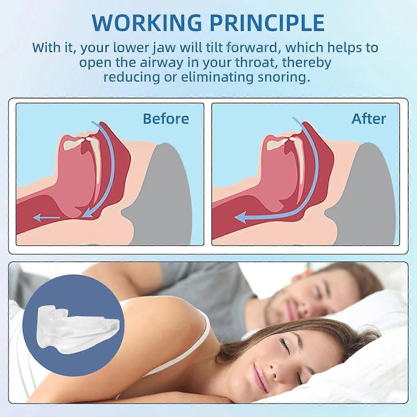Anti-Snoring Mouthpiece - Reusable, FDA-Cleared, with Case