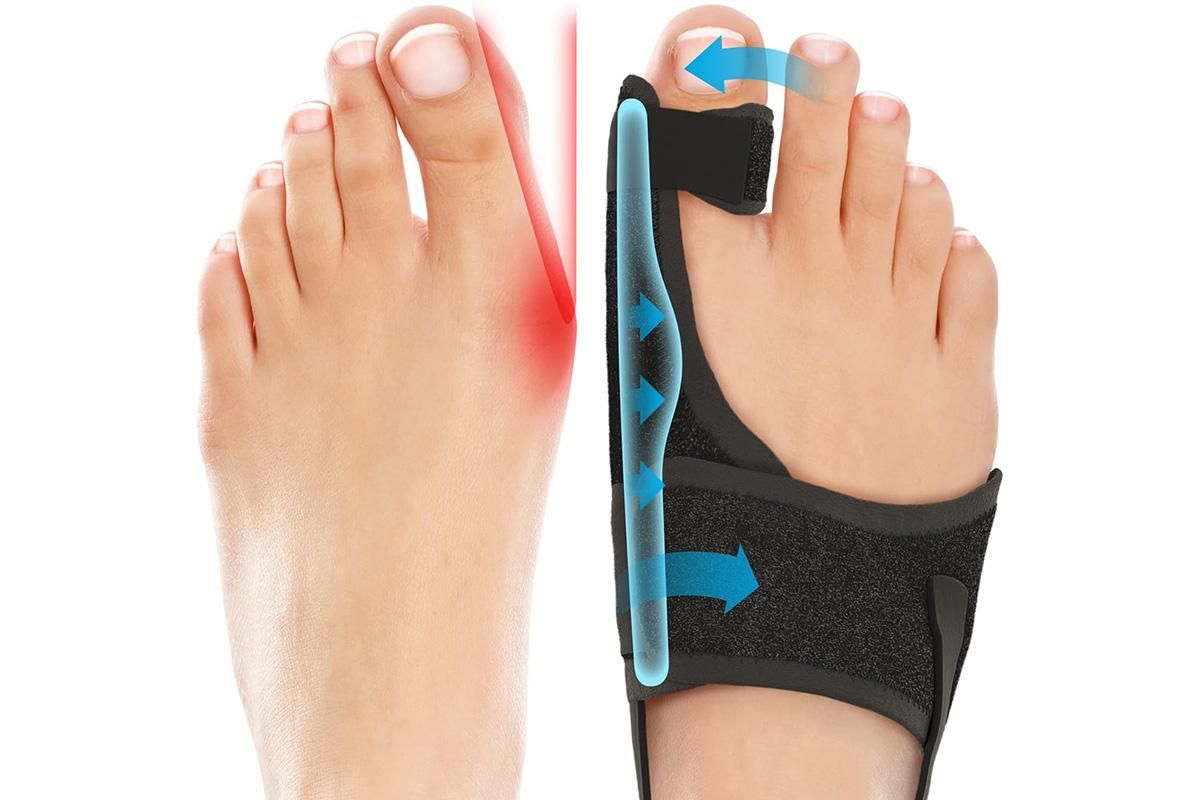 1 Pair Bunion Corrector Adjustable Length Orthopedic Toe Separator for Men and Women
