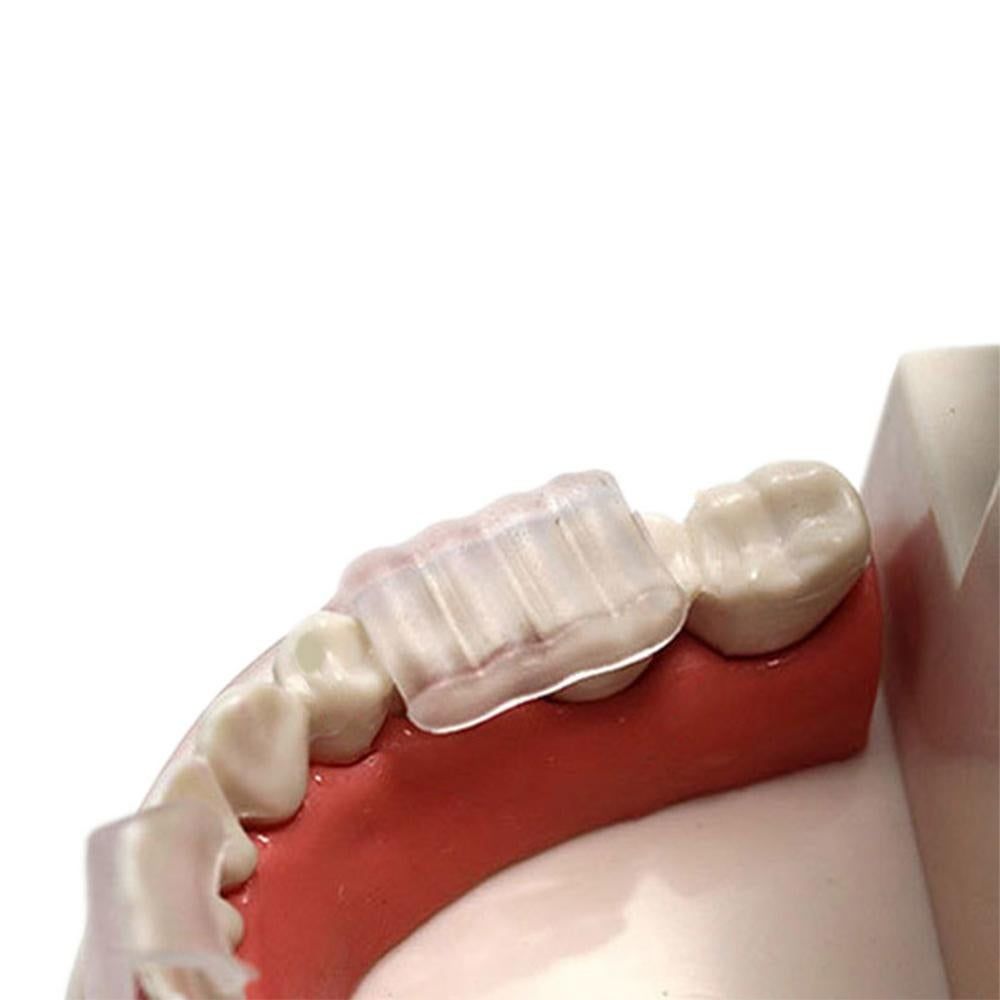 2pcs Anti Snore Mouth Guard Sleep Mouthguard Teeth Grinding Guard Dental Clenching Protector